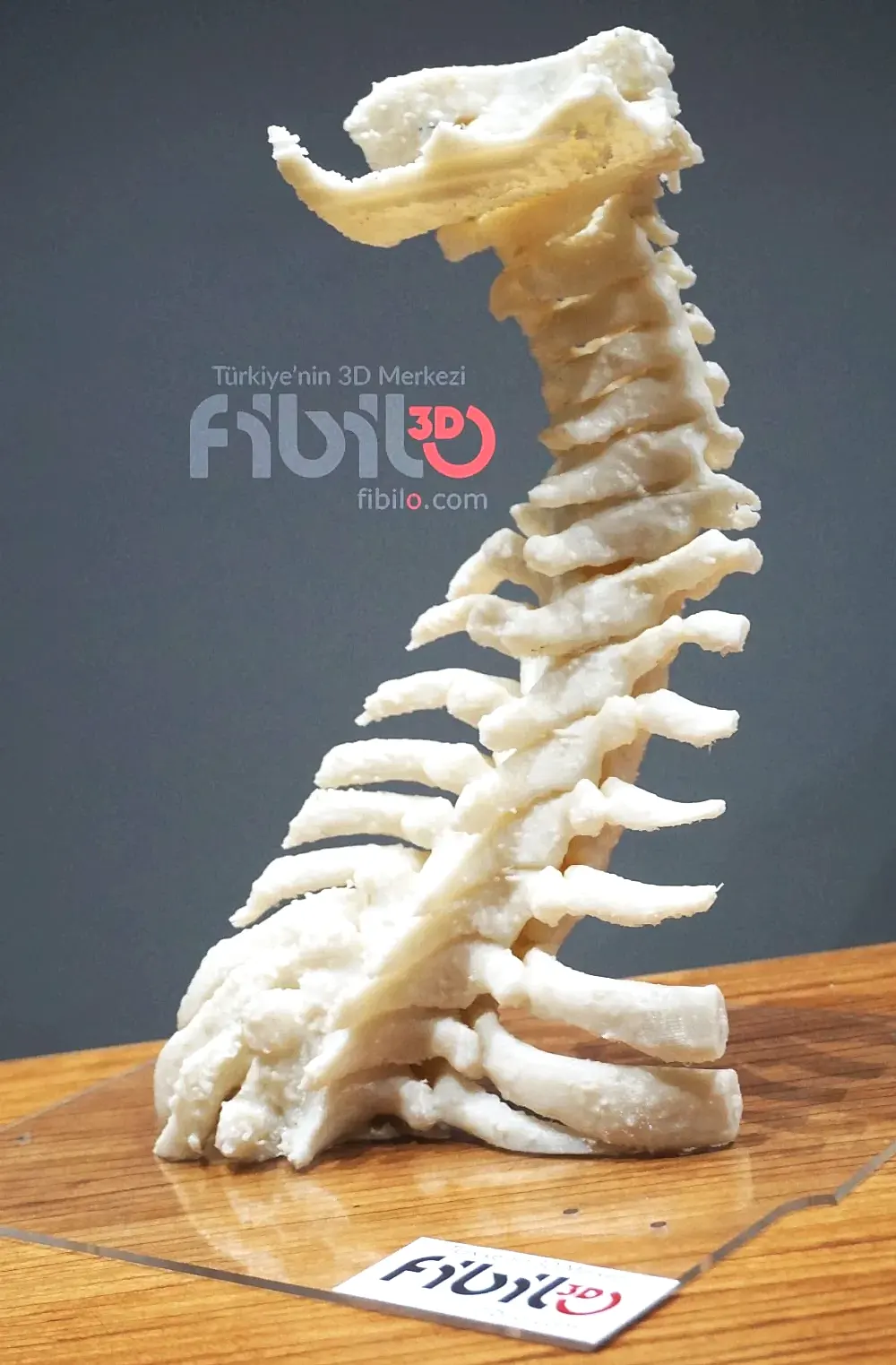 kemik 3d baskı
